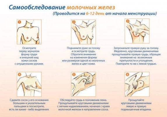 Этапы самообследования груди