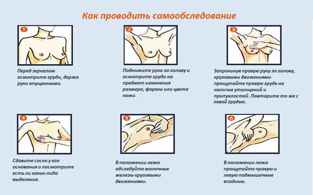Самостоятельное обследование груди